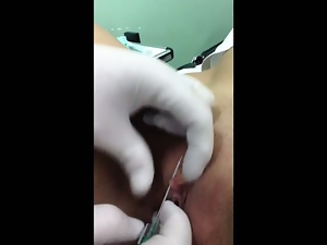 Il suo piercing al clitoride - My wife getting clit pierced